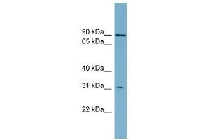 ABCD2 antibody used at 1 ug/ml to detect target protein. (CCL17 抗体)
