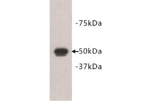 Western Blotting (WB) image for anti-FAT Tumor Suppressor Homolog 1 (FAT1) antibody (ABIN1854969) (FAT1 抗体)