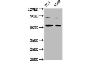 Western Blot Positive WB detected in: PC-3 whole cell lysate, A549 whole cell lysate All lanes: ARX antibody at 1:2000 Secondary Goat polyclonal to rabbit IgG at 1/50000 dilution Predicted band size: 59 kDa Observed band size: 59 kDa (Arx 抗体  (AA 381-460))
