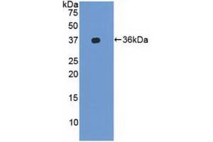 Western blot analysis of recombinant Human LFA1a. (ITGAL 抗体  (AA 809-1066))
