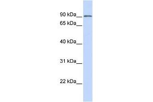 WB Suggested Anti-TRIM28 Antibody Titration: 0. (KAP1 抗体  (N-Term))