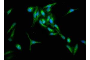 Immunofluorescence staining of Hela cells with ABIN7167114 at 1:133, counter-stained with DAPI. (RIN1 抗体  (AA 192-341))