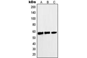 Western blot analysis of c-Myc (pS62) expression in A431 (A), HeLa (B), Jurkat (C) whole cell lysates. (c-MYC 抗体  (N-Term, pSer62))