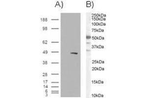 Image no. 1 for anti-SWI/SNF Related, Matrix Associated, Actin Dependent Regulator of Chromatin, Subfamily E, Member 1 (SMARCE1) (C-Term) antibody (ABIN374349) (SMARCE1 抗体  (C-Term))
