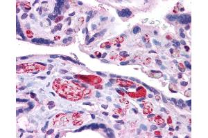 Immunohistochemistry (IHC) image for anti-Arginase, Liver (ARG1) (N-Term) antibody (ABIN2782309) (Liver Arginase 抗体  (N-Term))