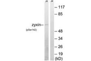 Western blot analysis of extracts from Jurkat cells treated with paclitaxel 1uM 24h, using Zyxin (Phospho-Ser142) Antibody. (ZYX 抗体  (pSer142))