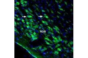 Expression of Homer3 in rat nucleus basalis - Immunohistochemical staining of perfusion-fixed frozen rat brain sections with Anti-Homer3 Antibody (ABIN7043275, ABIN7045172 and ABIN7045173), (1:1000), followed by goat anti-rabbit-AlexaFluor-488. (HOMER3 抗体  (Intracellular))