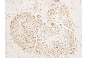 anti-Stromal Antigen 1 (STAG1) (AA 25-75) antibody