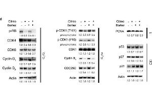 Western Blotting (WB) image for anti-Proliferating Cell Nuclear Antigen (PCNA) antibody (ABIN2854788)