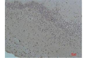 Immunohistochemistry (IHC) analysis of paraffin-embedded Rat Brain Tissue using Bestrophin-1 Rabbit Polyclonal Antibody diluted at 1:200. (Bestrophin 1 抗体)