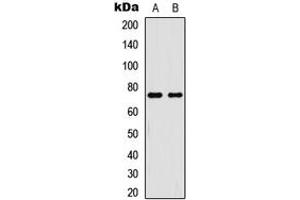 Western blot analysis of NF-kappaB p65 (pT254) expression in HeLa TNFa-treated (A), HL60 TNFa-treated (B) whole cell lysates. (NF-kB p65 抗体  (pSer254))