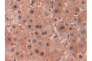 Detection of ADH1 in Human Liver Tissue using Polyclonal Antibody to Alcohol Dehydrogenase 1 (ADH1)