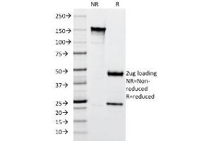 SDS-PAGE Analysis Purified Cytokeratin 10 Mouse Monoclonal Antibody (SPM261). (Keratin 10 抗体)