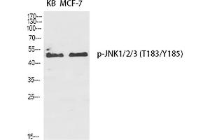 Western Blot analysis of KB (1), MCF-7 (2), diluted at 1:2000. (JNK 抗体  (pThr183))