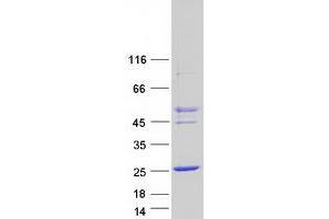 CTAG2 Protein (Transcript Variant 1) (Myc-DYKDDDDK Tag)