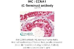 Image no. 1 for anti-Cyclin A1 (CCNA1) antibody (ABIN1732738) (Cyclin A1 抗体)