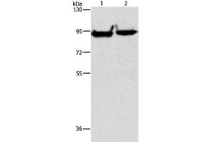 Western Blot analysis of Mouse heart and brain tissue using MARK1 Polyclonal Antibody at dilution of 1:500 (MARK1 抗体)
