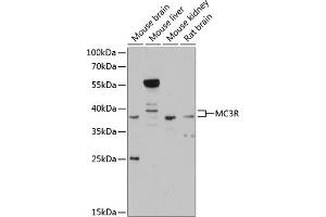 Western blot analysis of extracts of various cell lines, using MC3R antibody (ABIN6128220, ABIN6143613, ABIN6143616 and ABIN6215298) at 1:3000 dilution. (MC3R 抗体  (AA 1-120))