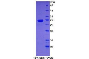 SDS-PAGE analysis of Human SHBG Protein. (SHBG 蛋白)