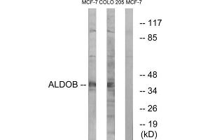 Western blot analysis of extracts from MCF-7 cells and HUVEC cells, using ALDOB antibody. (ALDOB 抗体  (Internal Region))