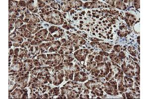 Image no. 5 for anti-THUMP Domain Containing 1 (THUMPD1) antibody (ABIN1501384) (THUMPD1 抗体)