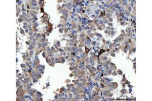 IHC analysis of MSF/SEPTIN9 using anti-MSF/SEPTIN9 antibody (ABIN7600104). (Septin 9 抗体  (AA 15-282))