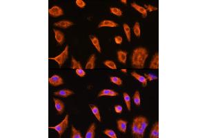 Immunofluorescence analysis of L929 cells using GST3/GST3/GSTP1 Rabbit pAb (ABIN6131722, ABIN6141480, ABIN6141481 and ABIN6221347) at dilution of 1:100 (40x lens). (GSTP1 抗体  (AA 1-210))