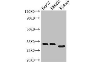 Western Blot Positive WB detected in: HepG2 whole cell lysate, HEK293 whole cell lysate, Mouse kidney tissue All lanes: GEMIN8 antibody at 4 μg/mL Secondary Goat polyclonal to rabbit IgG at 1/50000 dilution Predicted band size: 29 kDa Observed band size: 29, 33 kDa (GEMIN8 抗体  (AA 1-242))