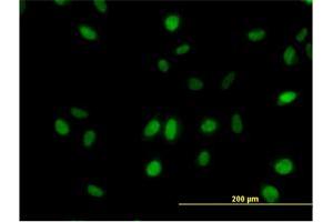 Immunofluorescence of monoclonal antibody to SURB7 on HeLa cell. (MED21 抗体  (AA 1-144))