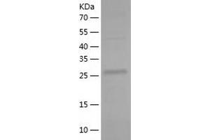 Western Blotting (WB) image for Zinc Finger Protein 439 (ZNF439) (AA 14-295) protein (His tag) (ABIN7125793) (ZNF439 Protein (AA 14-295) (His tag))