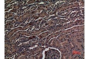 Immunohistochemistry (IHC) image for anti-Zinc Finger Protein 227 (ZNF227) (Internal Region) antibody (ABIN3187644)
