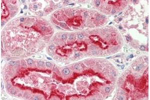 Human Kidney: Formalin-Fixed, Paraffin-Embedded (FFPE) (APMAP 抗体  (AA 74-123))