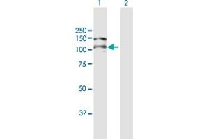 Western Blot analysis of ITGAV expression in transfected 293T cell line by ITGAV MaxPab polyclonal antibody. (CD51 抗体  (AA 1-1048))