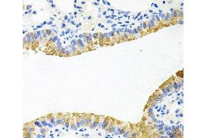Immunohistochemistry of paraffin-embedded Mouse lung using TOB2 Polyclonal Antibody at dilution of 1:100 (40x lens). (TOB2 抗体)