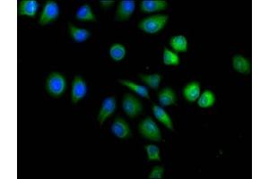 Immunofluorescence staining of A549 cells with ABIN7143677 at 1:120,counter-stained with DAPI. (ALDH3A1 抗体  (AA 210-453))