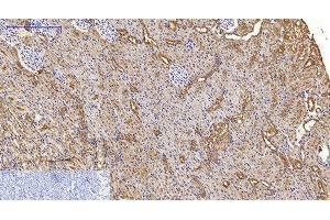 Immunohistochemistry of paraffin-embedded Rat kidney tissue using MAP1LC3A Monoclonal Antibody at dilution of 1:200. (MAP1LC3A 抗体)