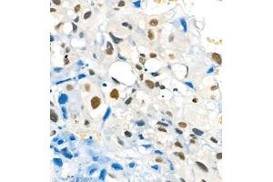 Immunohistochemistry of paraffin embedded rat placenta using Skar (ABIN7074970) at dilution of 1:1800 (400x lens) (p46 抗体)