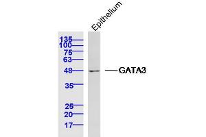 Mouse epithelium lysates probed with GATA3 Polyclonal Antibody, Unconjugated  at 1:300 dilution and 4˚C overnight incubation. (GATA3 抗体  (AA 151-250))