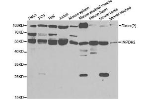 Western blot analysis of extracts of various cell lines, using IMPDH2 antibody (ABIN5973086) at 1/1000 dilution. (IMPDH2 抗体)