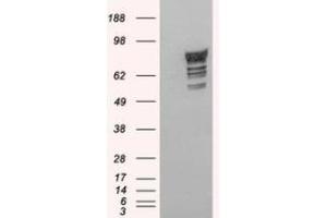 Image no. 1 for anti-phosphodiesterase 4D, cAMP-Specific (PDE4D) (C-Term) antibody (ABIN374635) (PDE4D 抗体  (C-Term))