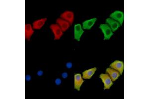 ABIN7095842 and ABIN7099904 staining Hela cells by IF/ICC. (SLC44A3 抗体)
