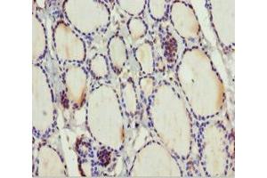 Immunohistochemistry of paraffin-embedded human thyroid tissue using ABIN7159798 at dilution of 1:100 (MTUS1 抗体  (AA 1041-1270))