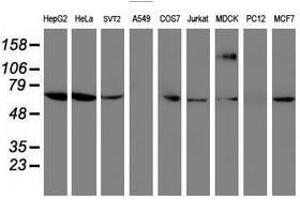 Image no. 3 for anti-Folate Hydrolase (Prostate-Specific Membrane Antigen) 1 (FOLH1) antibody (ABIN1500454) (PSMA 抗体)