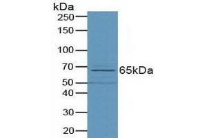 Detection of PLD in Porcine Small Intestine Tissue using Polyclonal Antibody to Phospholipase D (PLD) (Phospholipase D 抗体  (AA 725-1074))