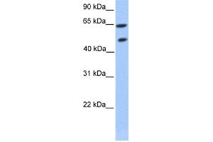 WB Suggested Anti-ZNF449 Antibody Titration: 0. (ZNF449 抗体  (Middle Region))