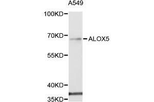 Western blot analysis of extracts of A-549 cells, using ALOX5 antibody (ABIN5971185) at 1/1000 dilution. (ALOX5 抗体)