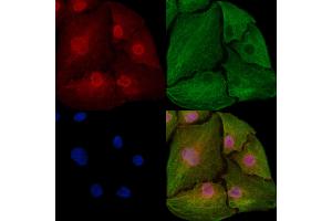 ABIN6259941 and ABIN6273031 staining  cells by IF/ICC. (Annexin VII 抗体  (N-Term))