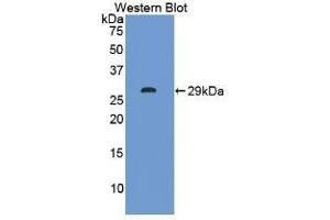 Detection of Recombinant ITLN1, Human using Polyclonal Antibody to Intelectin 1 (ITLN1) (ITLN1/Omentin 抗体  (AA 31-253))