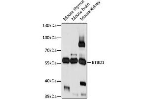 Western blot analysis of extracts of various cell lines, using BTBD1 antibody (ABIN6291275) at 1:1000 dilution. (BTBD1 抗体)