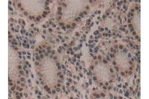 Detection of HDGF in Human Stomach Tissue using Polyclonal Antibody to Hepatoma Derived Growth Factor (HDGF) (HDGF 抗体  (AA 10-240))